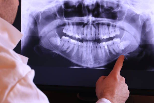 Best Urgent Dental Care for Toothache in Eleanor, WV