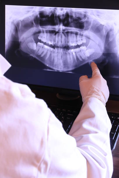 Best Emergency Dental Extractions in Eleanor, WV