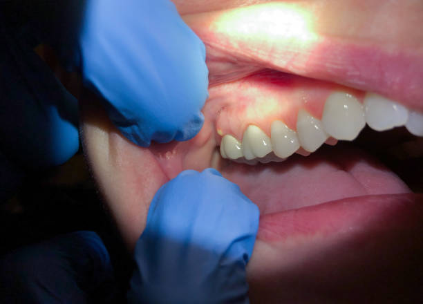 Best Emergency Cosmetic Dentistry in Eleanor, WV