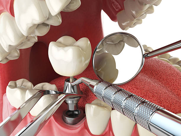 Best Weekend Emergency Dentist in Eleanor, WV